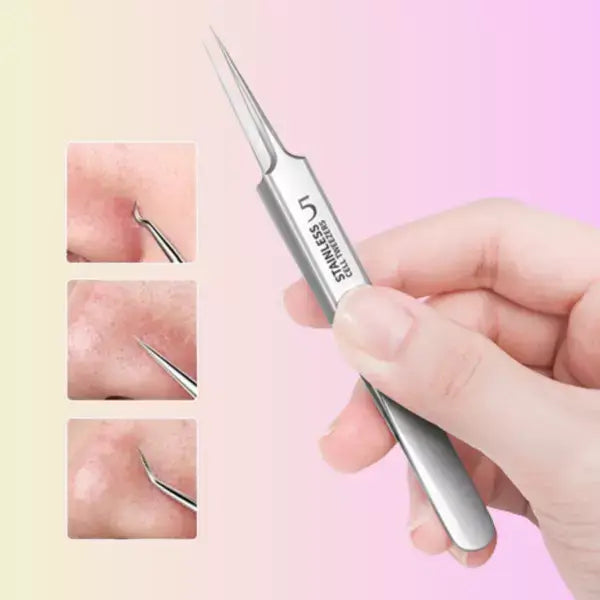 Pinças Super Clamp - Kit Removedor de Cravos e Espinhas [COMPRE 1 LEVE 3]