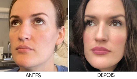 Eye Stick - Hidratante Rejuvenescedor para a Pele dos Olhos