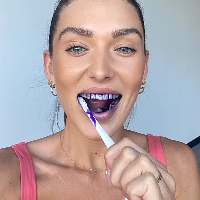 Clareador Dental HiSmile - A nova fórmula para deixar seus dentes brancos!