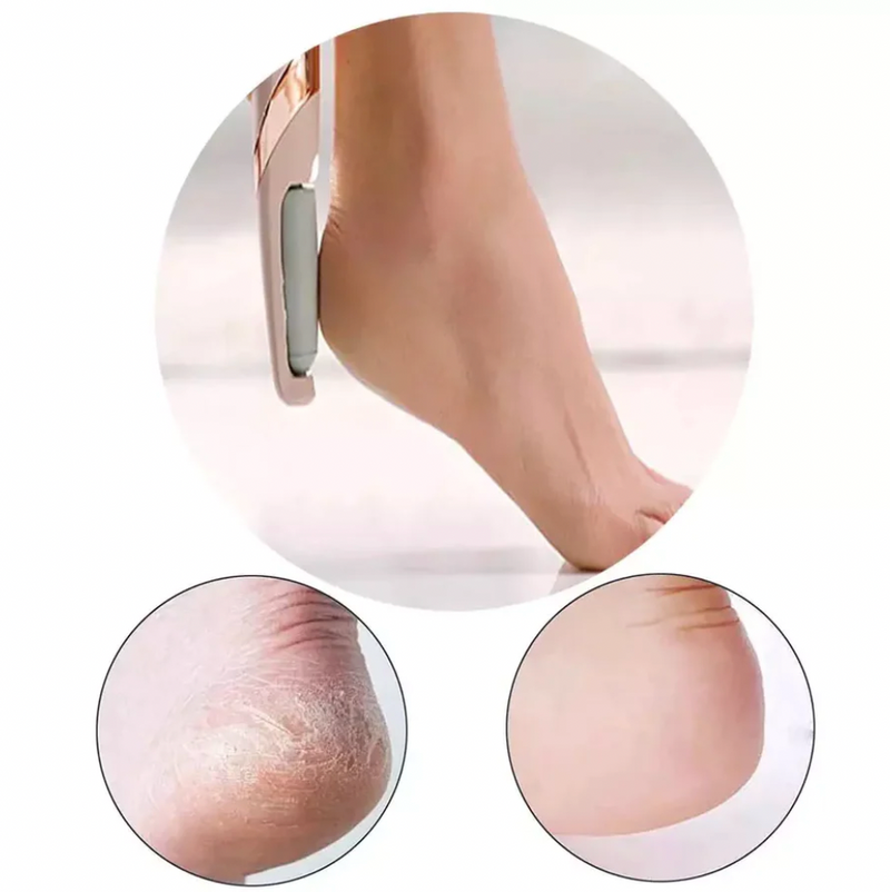 Beauty Feet - Lixa de Pé Elétrica com Bateria Recarregável e Controle de Velocidade